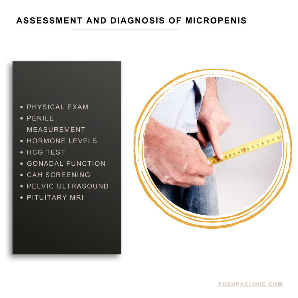 Assessment and Diagnosis of Micropenis