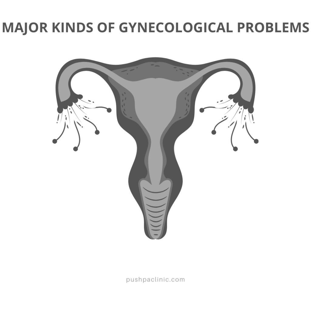 Major Kinds of Gynecological Problems